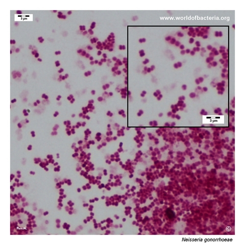 Gram-negative Neisseria gonorrhoeae diplococci in a smear prepared from a cultured colony