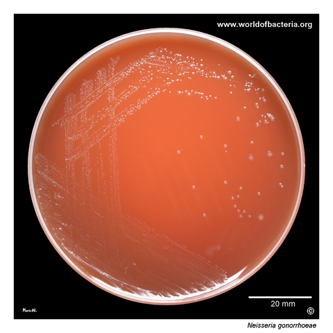 Semi-transparent pearly Neisseria gonorrhoeae colonies on selective agar from a vaginal swab