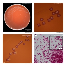 Composite laboratory image panel of Neisseria gonorrhoeae with preview photographs from the species overview page
