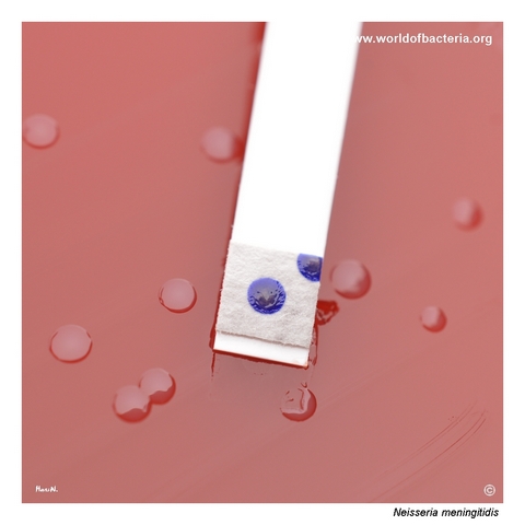 Positive oxidase reaction produced by Neisseria meningitidis