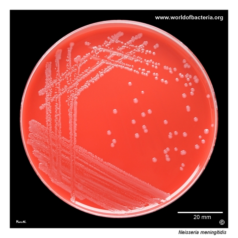 Small non-haemolytic Neisseria meningitidis colonies on blood agar from a respiratory specimen
