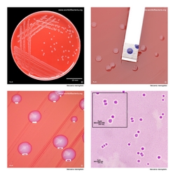 Composite laboratory image panel of Neisseria meningitidis with preview photographs from the species overview page