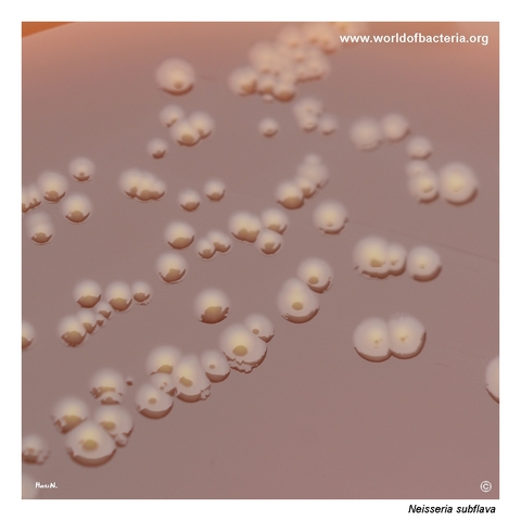 Yellow Neisseria subflava colonies ranging from convex to flat with raised centres