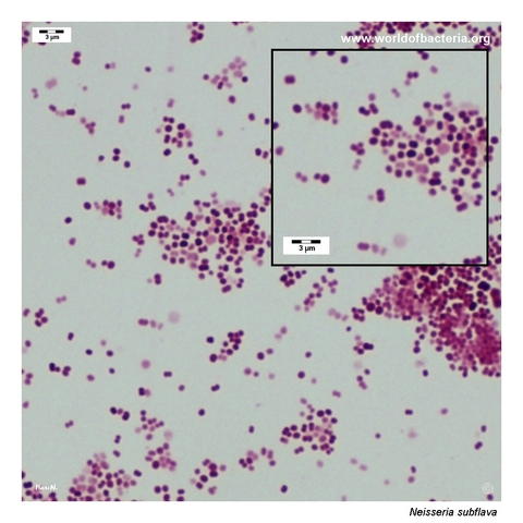 Gram-negative Neisseria subflava cocci occurring singly and as diplococci