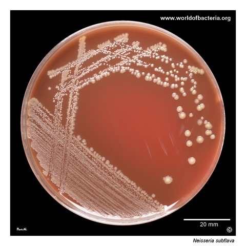 Yellow-pigmented Neisseria subflava colonies on blood agar after 48 hours