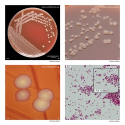 Composite laboratory image panel of Neisseria subflava with preview photographs from the species overview page