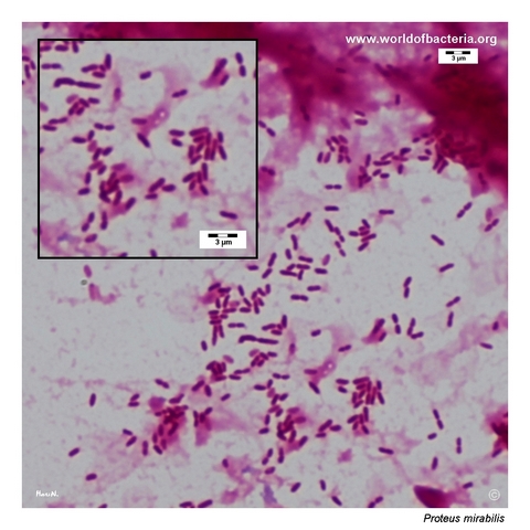 Gram-negative Proteus mirabilis rods in a positive blood culture