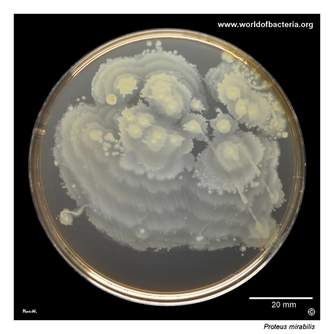 Swarming growth of Proteus mirabilis with pale lactose-non-fermenting colonies on MacConkey agar