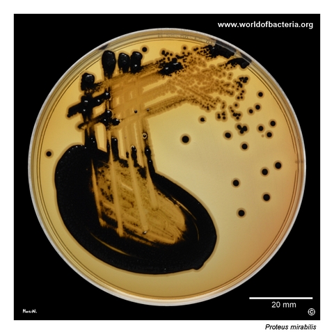 Proteus mirabilis colonies with black centres caused by hydrogen sulphide production on deoxycholate citrate agar
