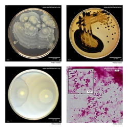Composite laboratory image panel of Proteus mirabilis with preview photographs from the species overview page