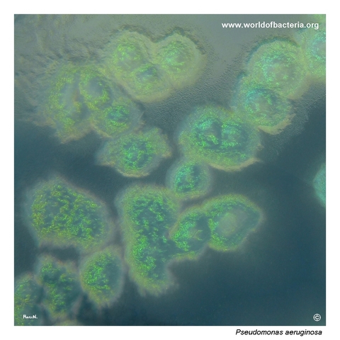 Green-pigmented Pseudomonas aeruginosa colonies on selective cetrimide agar