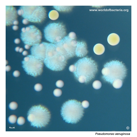 Bluish Pseudomonas aeruginosa, yellow Staphylococcus aureus, and white Enterococcus faecalis colonies on tryptic soy agar