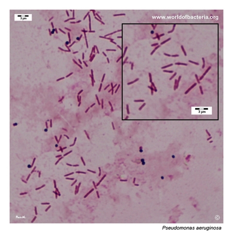 Slender Gram-negative Pseudomonas aeruginosa rods with occasional Staphylococcus epidermidis cocci in urine