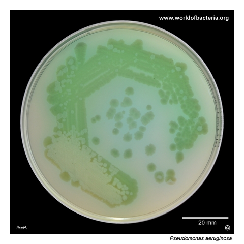 Green pigment produced by Pseudomonas aeruginosa on Mueller–Hinton agar