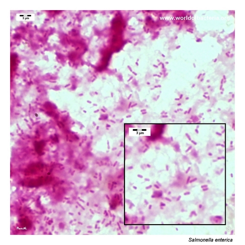 Gram-negative Salmonella Enteritidis rods in a positive blood culture
