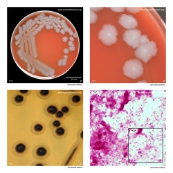 Composite laboratory image panel of Salmonella enterica with preview photographs from the species overview page