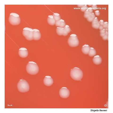 Smooth convex grey-white Shigella flexneri colonies on blood agar