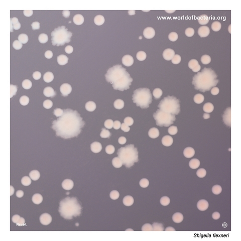 Two colony forms of lactose-non-fermenting Shigella flexneri CCM 4422 on MacConkey agar