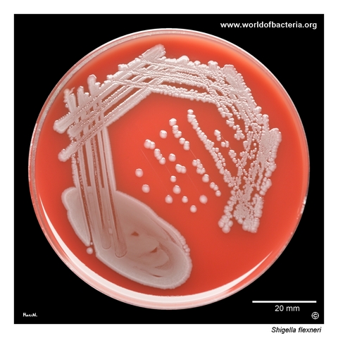 Shigella flexneri CCM 4422 forming non-haemolytic colonies on blood agar
