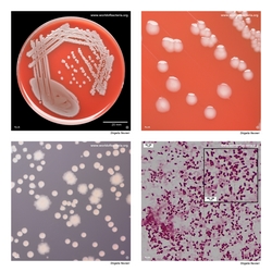 Composite laboratory image panel of Shigella flexneri with preview photographs from the species overview page