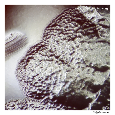 Highly magnified coarse beaten-metal surface of a Shigella sonnei colony
