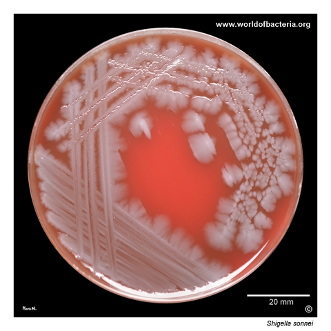 Large irregular spreading colonies of Shigella sonnei on blood agar