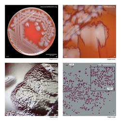 Composite laboratory image panel of Shigella sonnei with preview photographs from the species overview page