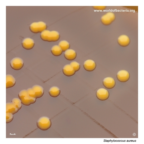 Anaerobic culture of Staphylococcus aureus colonies on Schaedler agar