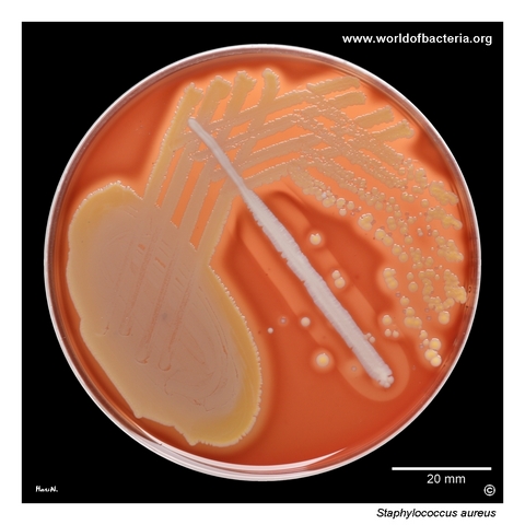 Blood agar culture with Staphylococcus aureus colonies and beta-hemolysis