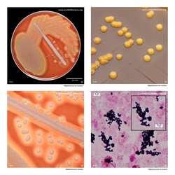 Composite laboratory image panel of Staphylococcus aureus with preview photographs from the species overview page
