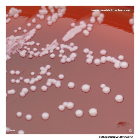 Slow-growing small colonies of Staphylococcus auricularis after prolonged incubation