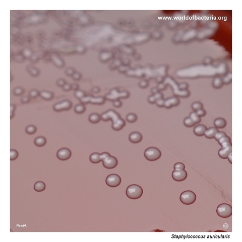 Small shiny convex colonies of Staphylococcus auricularis on blood agar