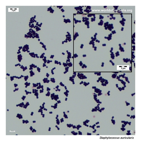 Gram-stained smear from a colony of Staphylococcus auricularis