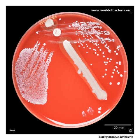 Small non-pigmented non-haemolytic colonies of Staphylococcus auricularis on blood agar