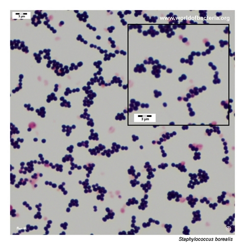 Gram-stained smear prepared from a colony of Staphylococcus borealis grown on blood agar.