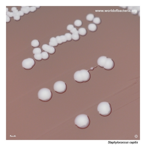 Non-pigmented non-haemolytic colonies of Staphylococcus capitis on blood agar