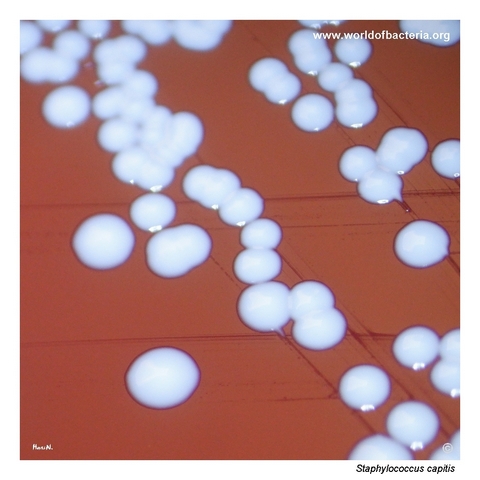Close-up of smooth convex colonies of Staphylococcus capitis on blood agar