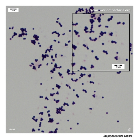 Gram-stained smear from a colony of Staphylococcus capitis grown on blood agar