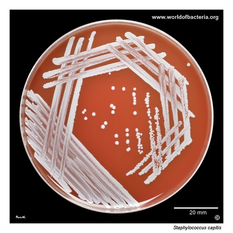 Staphylococcus capitis on blood agar after 24 hours of incubation