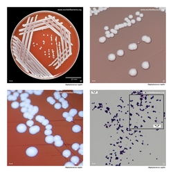 Composite laboratory image panel of Staphylococcus capitis with preview photographs from the species overview page