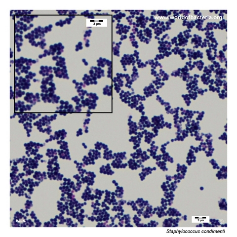 Gram-stained smear from a colony of Staphylococcus condimenti grown on blood agar