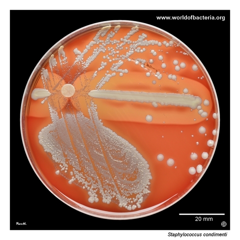Staphylococcus condimenti on blood agar from a vaginal swab specimen