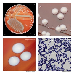 Composite laboratory image panel of Staphylococcus condimenti with preview photographs from the species overview page