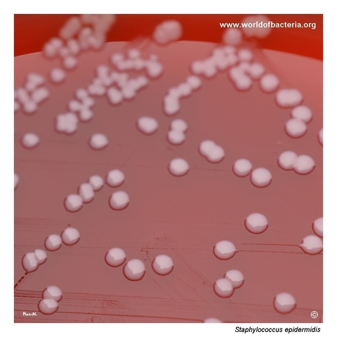 Colonies of Staphylococcus epidermidis on sheep blood agar after 24 hours
