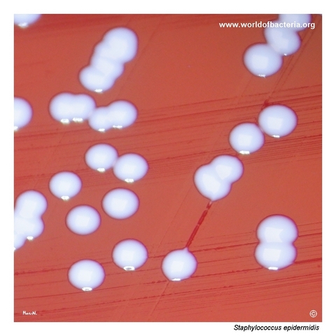 Close-up of smooth convex grey-white Staphylococcus epidermidis colonies on blood agar