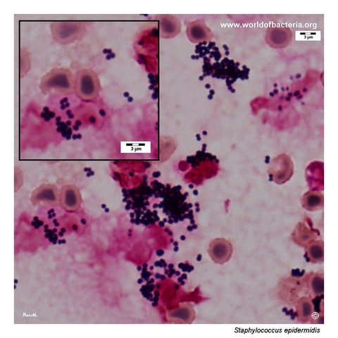 Gram-stained smear from a positive blood culture with Staphylococcus epidermidis