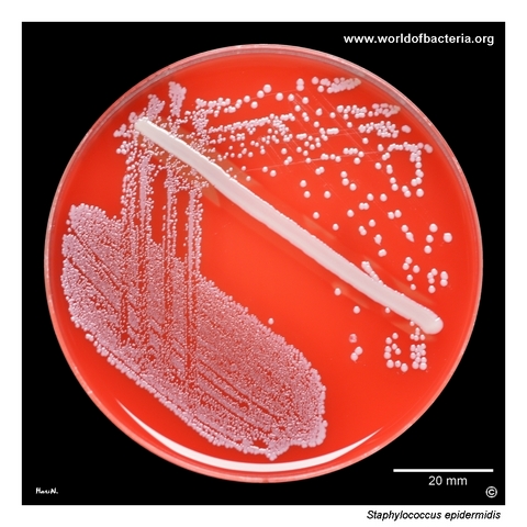 Blood agar culture with small grey-white Staphylococcus epidermidis colonies without haemolysis