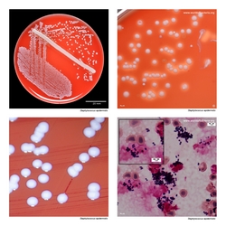 Composite laboratory image panel of Staphylococcus epidermidis with preview photographs from the species overview page
