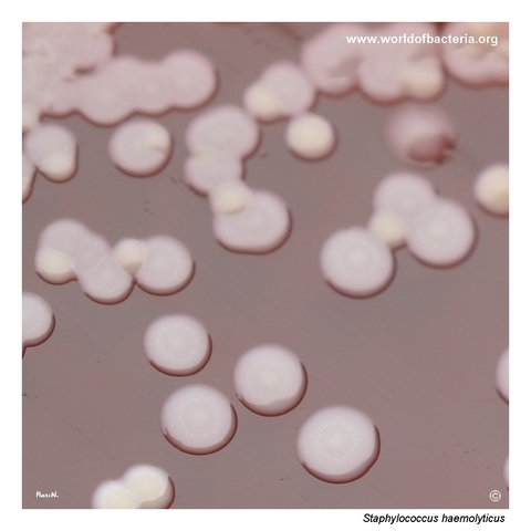 Faintly yellow-pigmented colonies of Staphylococcus haemolyticus