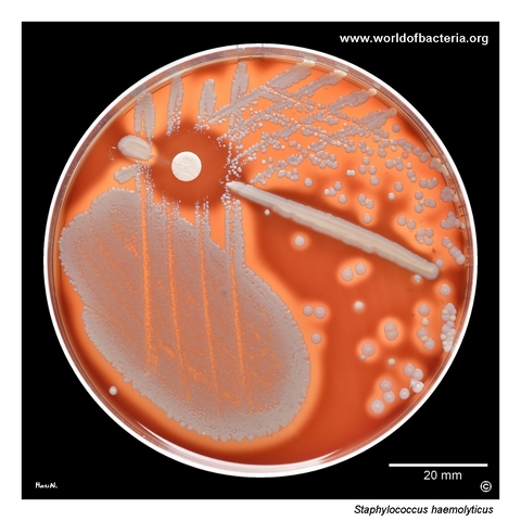Beta-haemolytic colonies of Staphylococcus haemolyticus on blood agar